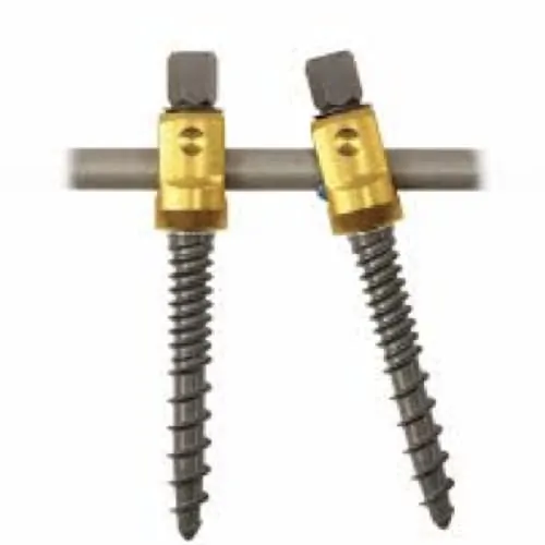 arthrodese lombaire par voie posterieure arthrodese lombaire posterieure chirurgie du rachis espace francilien du rachis clinique du rachis versailles paris 4