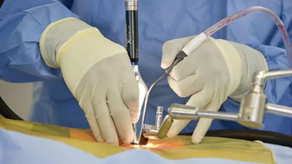 chirurgie d une hernie discale lombaire symptomes hernie discale lombaire operation chirurgie du rachis espace francilien du rachis clinique du rachis versailles paris 2