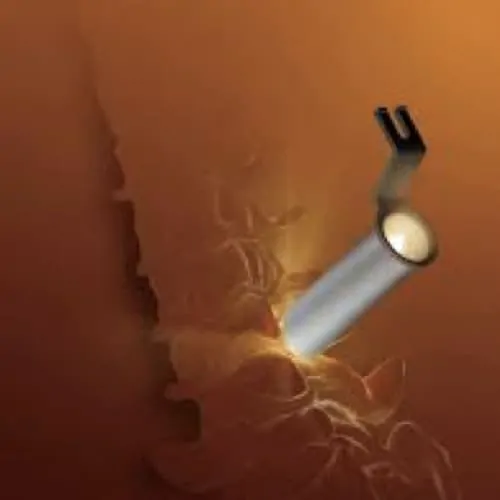 chirurgie mini invasive du canal lombaire etroit la chirurgie mini invasive hernie discale espace francilien du rachis clinique du rachis versailles paris 1