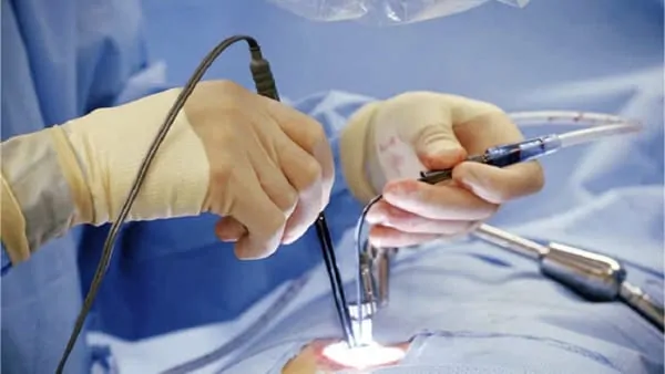 chirurgie mini invasive du canal lombaire etroit la chirurgie mini invasive hernie discale espace francilien du rachis clinique du rachis versailles paris 9 chirurgie mini invasive du canal lombaire etroit la chirurgie mini invasive hernie discale espace francilien du rachis clinique du rachis versailles paris 9