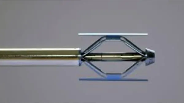 cyphoplastie par ballonnets kyphoplastie vertebroplastie kyphoplastie lombaire chirurgie du rachis espace francilien du rachis clinique du rachis versailles paris
