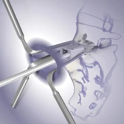 prothese discale lombaire prix chirurgie prothese discale lombaire reeducation chirurgie du rachis espace francilien du rachis clinique du rachis versailles paris
