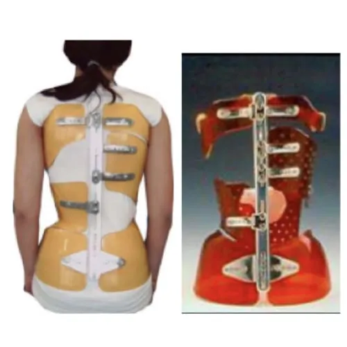 scoliose ado probleme de dos la scoliose lombaire scoliose definition scoliose traitement espace francilien du rachis clinique du rachis versailles paris 7