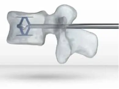 Spinejack stryker