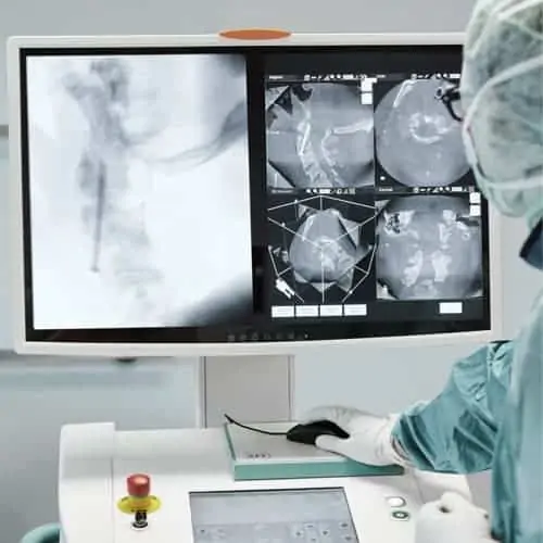 systeme imagerie ziehm 3d espace francilien rachis docteur jameson docteur lamerain