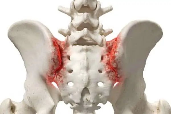 brucellose symptome diagnostic espace francilien rachis chirurgien specialiste dos colonne vertebrale paris dr jameson dr lamerain medecin de la douleur dr hayon dr labourdette paris
