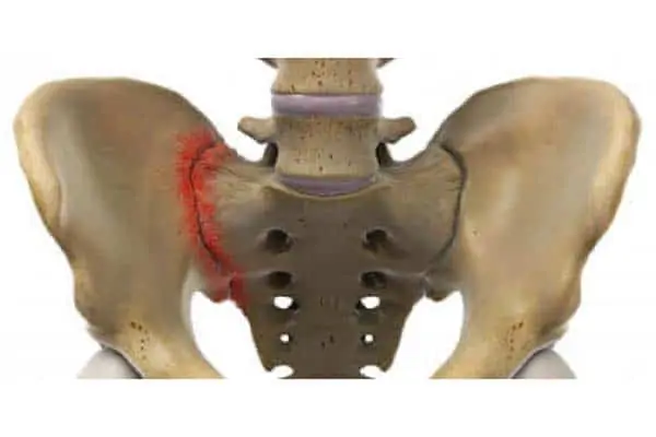 douleur sacro iliaque espace francilien rachis chirurgien specialiste dos colonne vertebrale paris dr jameson dr lamerain medecin de la douleur dr hayon dr labourdette paris