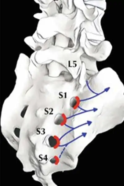 douleurs sacro iliaques espace francilien rachis chirurgien specialiste dos colonne vertebrale paris dr jameson dr lamerain medecin de la douleur dr hayon dr labourdette paris